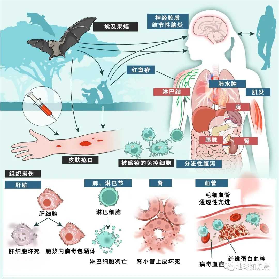 感染了病毒的患者，全身上下幾乎沒有一處好的地方