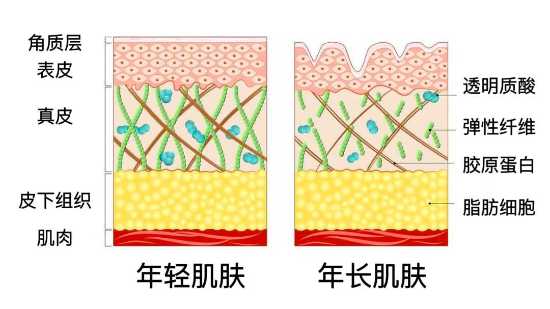 你的皺紋是動態紋or靜態紋？